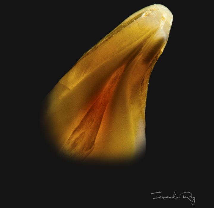 Dr. Cremades Estética Dental - Fotografía Fernando Rey