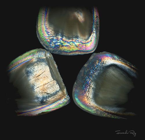 Dr. Cremades Estética Dental - Fotografía Fernando Rey